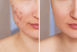Comparison Image for skin-care - 2